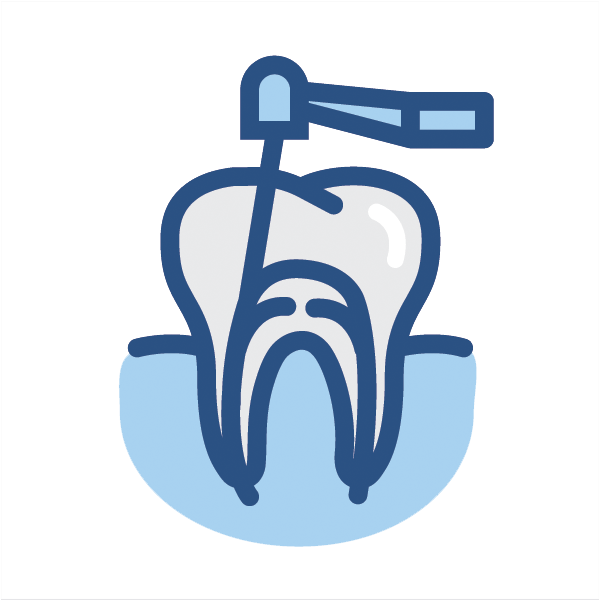 Root Canal Therapy